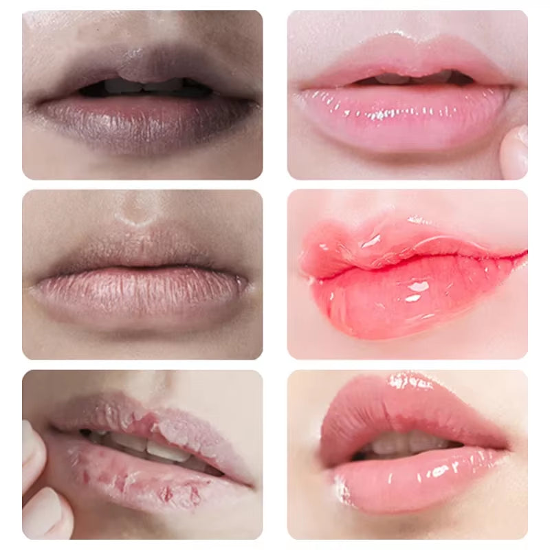 Dark Lip Lightening Balm: Exfoliating, Moisturizing, and Glossy Treatment for Healthier Lips