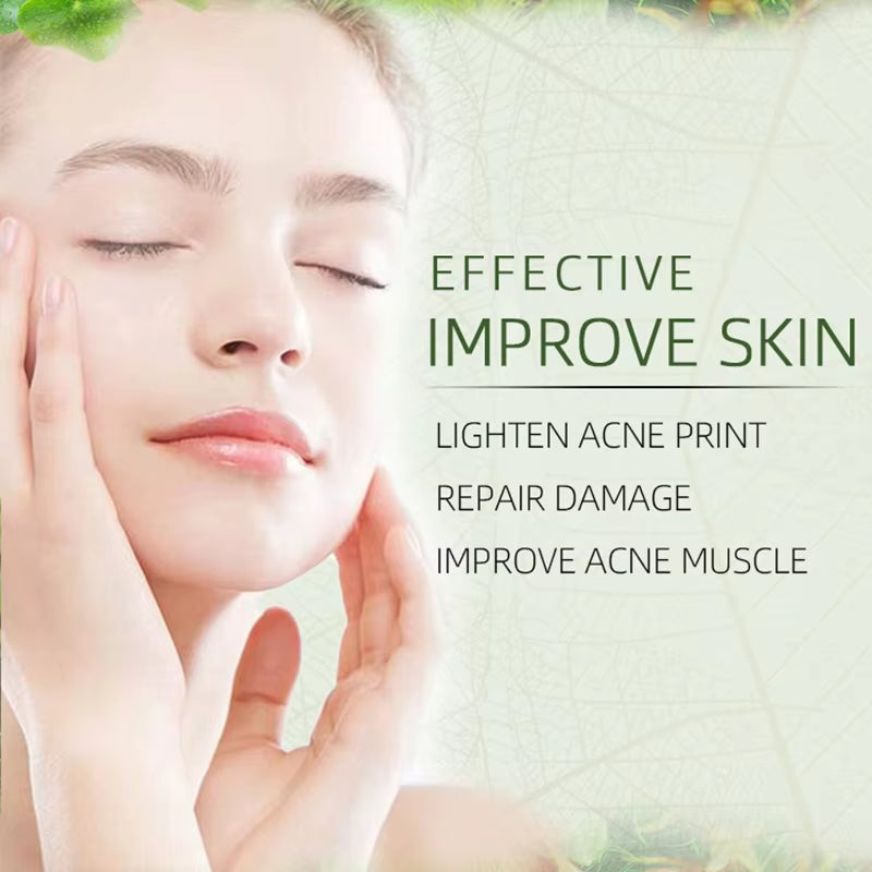 Joypretty Herbal Acne Removal Face Cream: Pimple Treatment and Moisturizing Repair for Clearer Skin