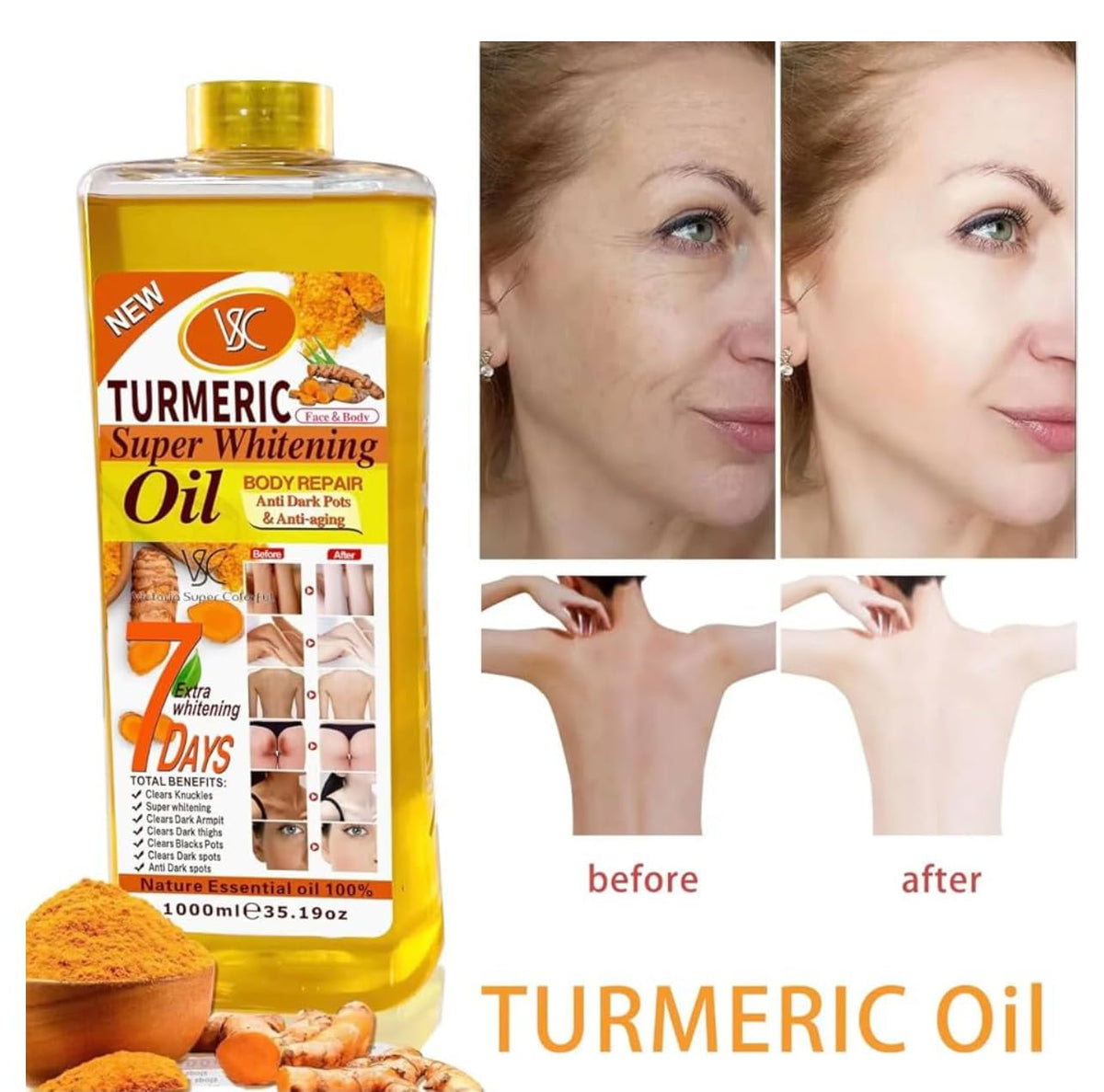 Turmeric Oil Face & Body Moisturizer – Brightening, Anti-Aging, Spot Correcting Skincare Essential Oil, 1000ML (35.19 fl oz)