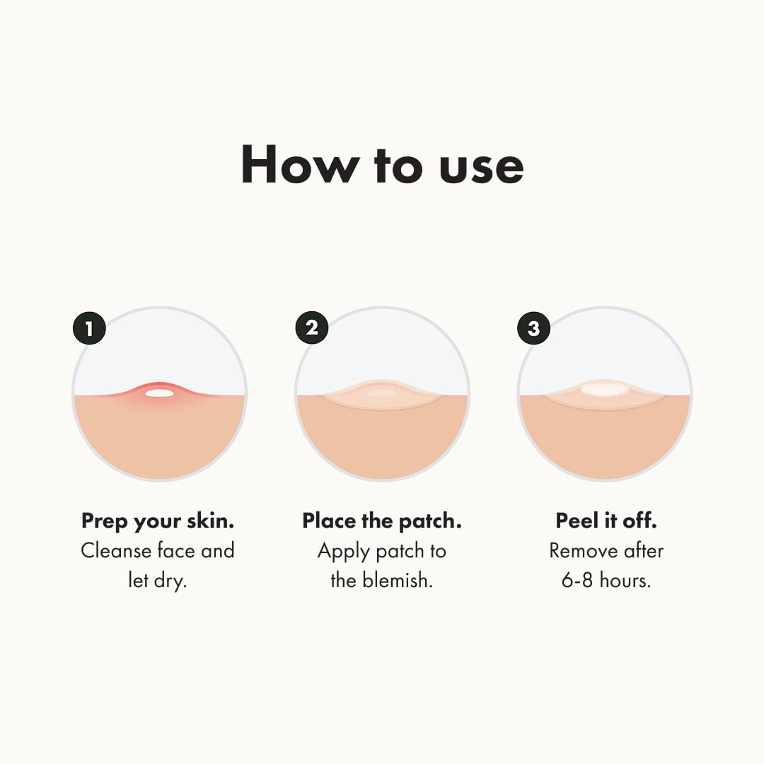 Mighty Patch™ Original Acne Pimple Patch by Hero Cosmetics – Hydrocolloid Acne & Pimple Patches for Fast Zit & Whitehead Healing, Nighttime Face Stickers, 72 Count