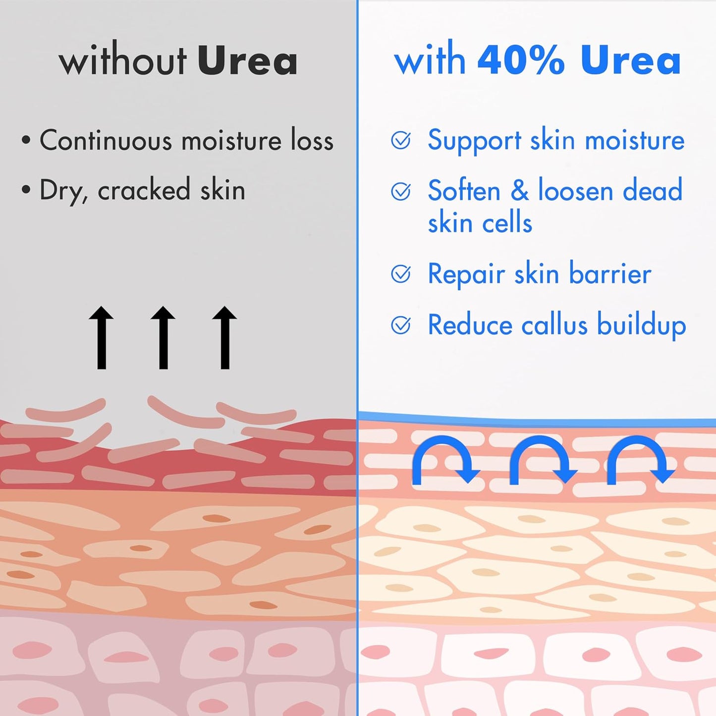 Ebanel Urea Cream 40% + Salicylic Acid 2% – Intensive Foot Cream for Dry, Cracked Heels, Callus & Dead Skin Removal, Skin Barrier Repair