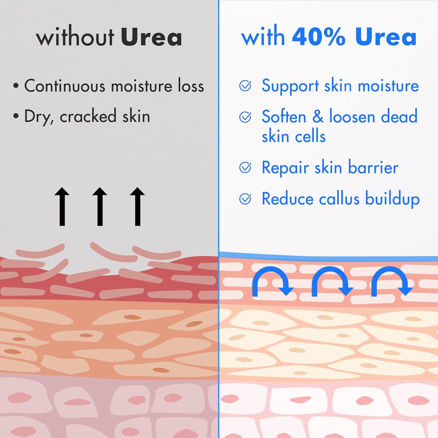 Ebanel Urea Cream 40% + Salicylic Acid 2% – Intensive Foot Cream for Dry, Cracked Heels, Callus & Dead Skin Removal, Skin Barrier Repair