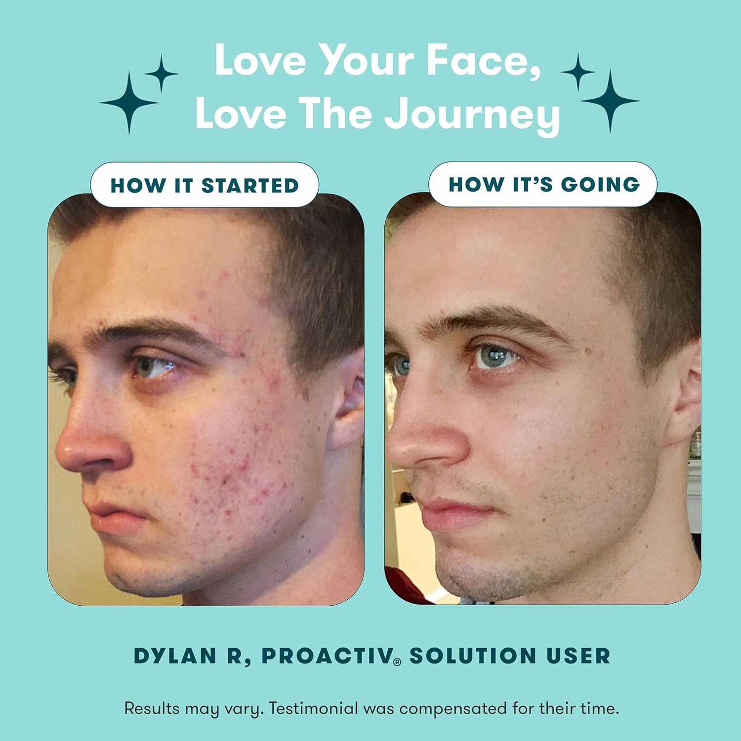 Proactiv 3-Step Acne Treatment – Benzoyl Peroxide Face Wash, Exfoliating Toner, Acne Spot Treatment & Repairing Spot Treatment for Face & Body | Complete 30-Day Kit