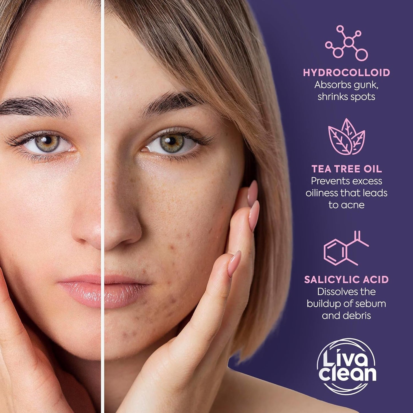 Livaclean Star Pimple Patches for Face – Hydrocolloid Acne Stickers with Tea Tree Oil, Salicylic Acid, Zit Stickers for Fast Healing, & Cute Acne Patch Stickers